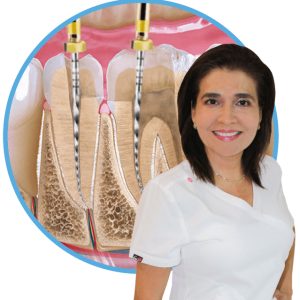 Endodoncia en Matamoros Tamaulipas, Dra. Leticia Tobías Orta